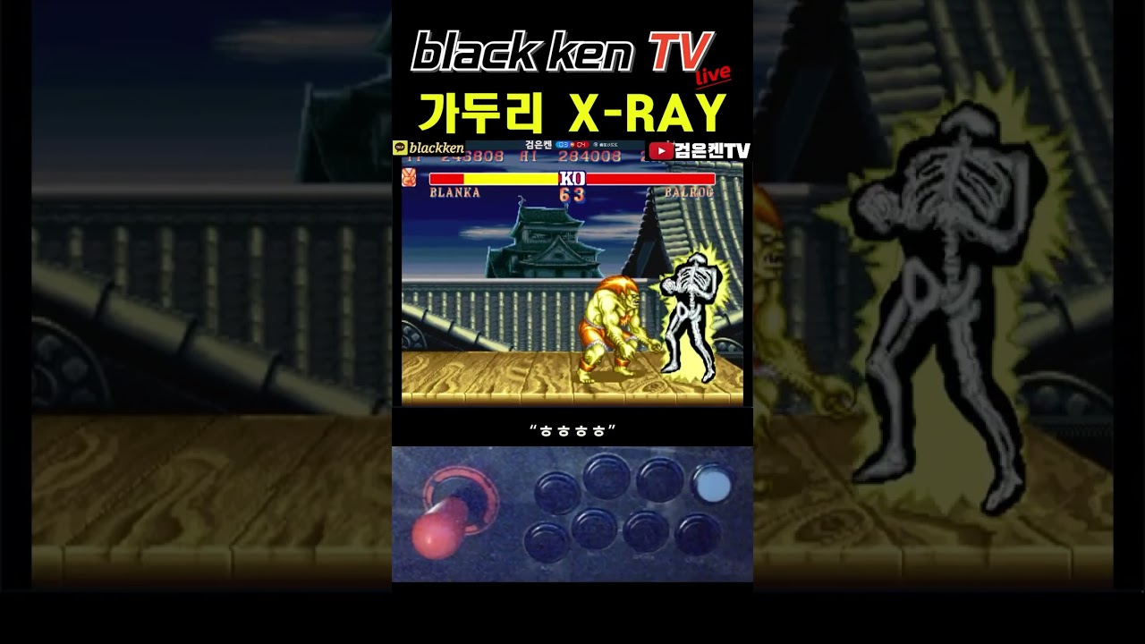 가두리 X-RAY