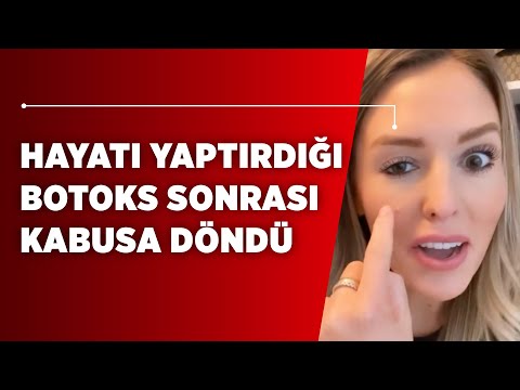 Video: Blefaroplastikadan sonra aşağı göz qapağını necə masaj etmək olar?