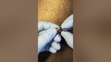 How to load a Tofflemire Matrix Band #dentalassistanteducation #dentalassisting