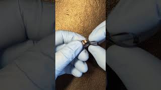 How to load a Tofflemire Matrix Band #dentalassistanteducation #dentalassisting