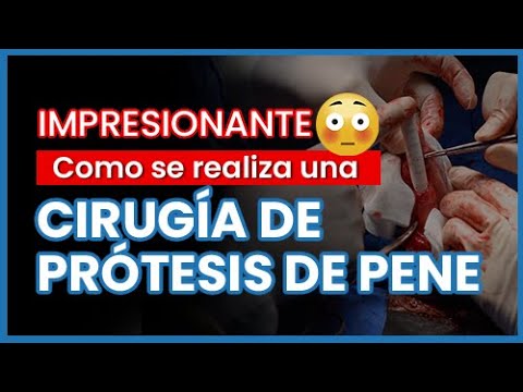 Impresionante Cirugía😱 | PRÓTESIS DE PENE Maleable Tactra™ | Paciente recupera ERECCIÓN