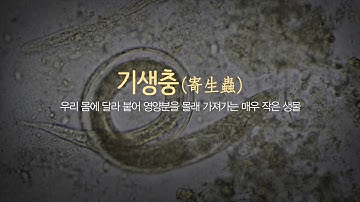 우리 몸 속, 아직도 기생충이? [건강플러스]