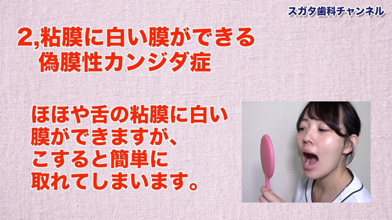 高松市 健康 歯医者 ピリピリ痛い 口腔カンジダ症って スガタ歯科チャンネル080 口腔ケアチャンネル Youtube
