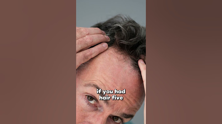 BALDNESS REVERSED: EXPLORING THE CURE AND LIMITATIONS FOR REGROWTH