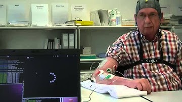 Brain Computer interface used for rehabilitation after a stroke