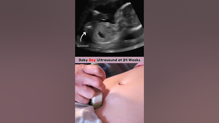 Baby Boy on Ultrasound | Fetal Gender Ultrasound 🤩