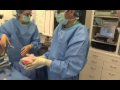 Kidney Transplant Chain | UCLA Kidney Exchange Program