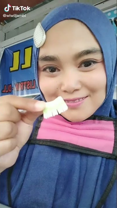 diprank pake gigi tonggos 🤣😅
