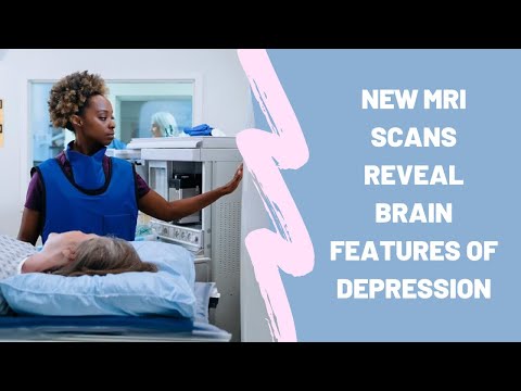 New MRI scans reveal brain features of depression