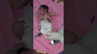 RBS Test in Preterm Baby 😱#shorts #newborn #youtubeshorts #trending #viralshort #nicucare #rbstest