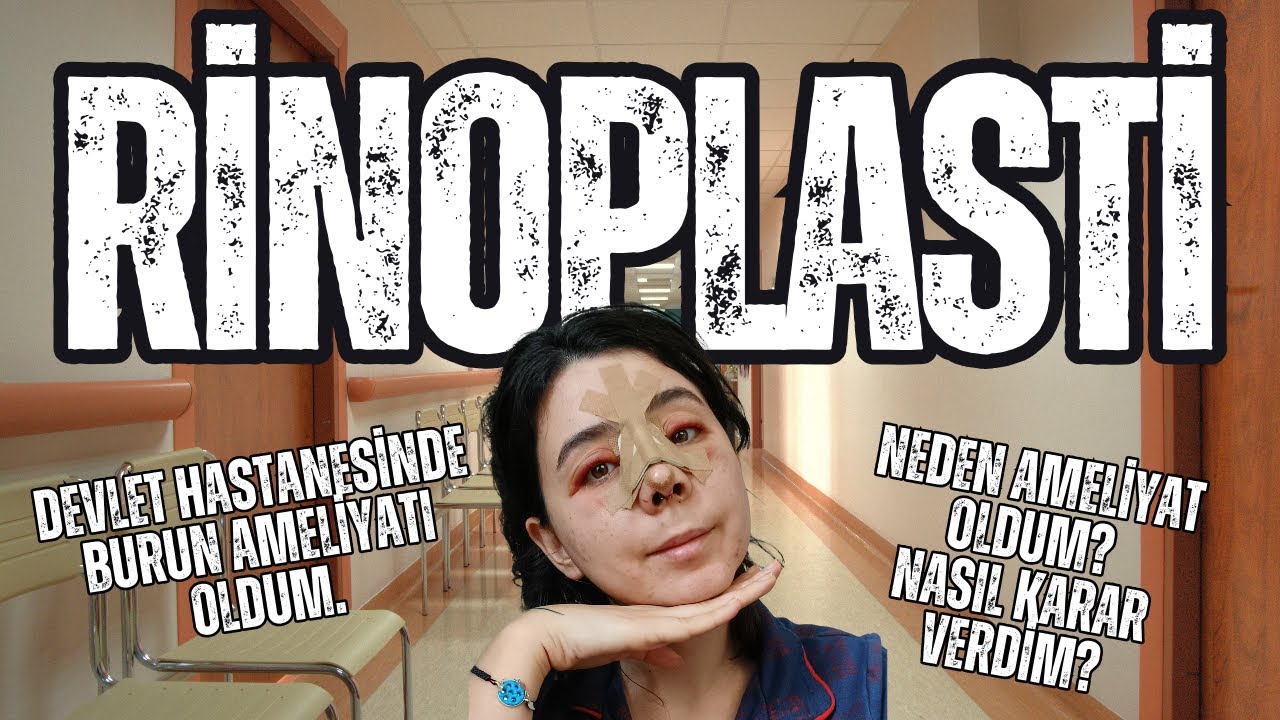 DEVLET HASTANESİNDE BURUN AMELİYATI OLDUM! NEDEN AMELİYAT OLDUM? NASIL KARAR VERDİM? #burunestetiği