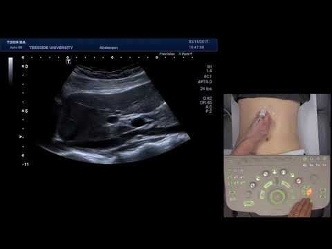 How to scan the Upper Abdomen