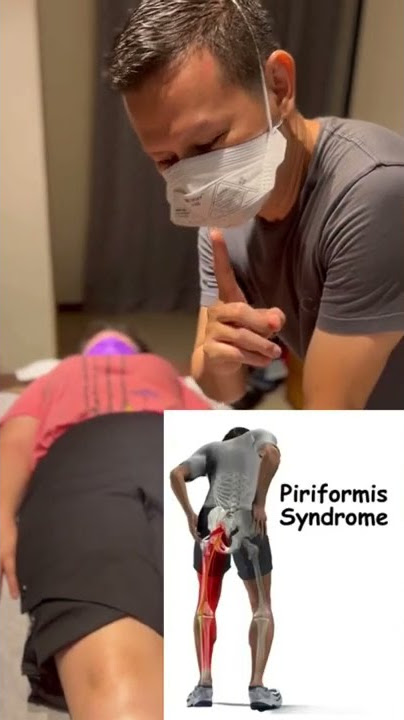 Streching untuk nyeri pada bokong ( piriformis syndrome )