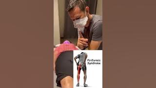 Stretching for pain in the buttocks ( piriformis syndrome )