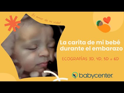 Caritas de bebés en ecografías 3D, 4D, 5D y 6D