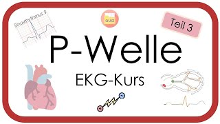 EKG - P-Welle (Sinusrhythmus, SA-Block, P-Pulmonale, P-Mitrale, P-Bitrale) EKG-Kurs Teil 3