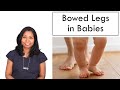 Bowed Legs in Babies – Reason & Cure