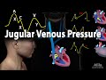 Jugular Venous Pressure, Animation