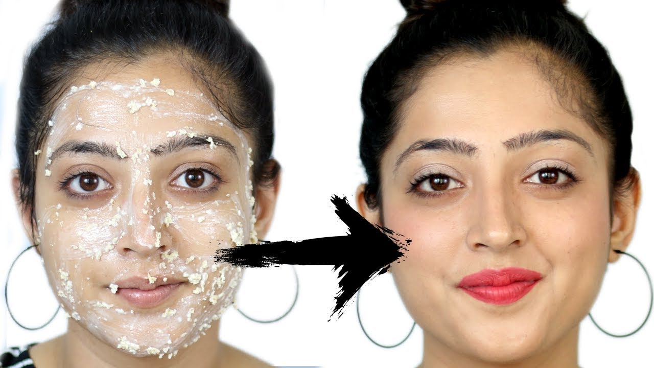 Face Pack for Acne Prone Skin मुहांसों के लिए फेस पैक YouTube