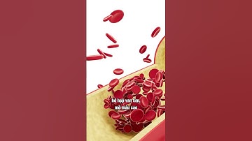 Vì sao mùa đông dễ gây đột quỵ? #dotquy