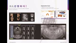 Dentium Rainbow MCT