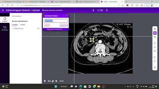 Training YOLOv7 on a Custom Dataset call or WhatsApp +91-8909603708 for Research Projects