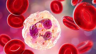 Bone Marrow Transplant for Immune Deficiency by Dr Sagar Bhattad