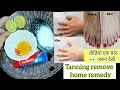 Skin Par Ye Lagaya Aur Dekho Kya Hua... 😱 Instant Whitening Remedy! Trending remedy 2025