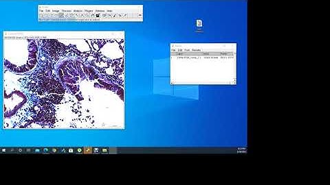 Collagen Determination in Histological Slide by ImageJ software.