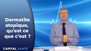 Dermatite atopique, qu'est ce que c'est ?