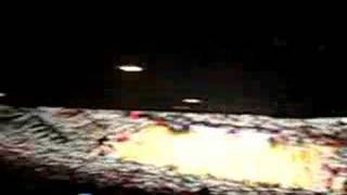 IU vs. Duke