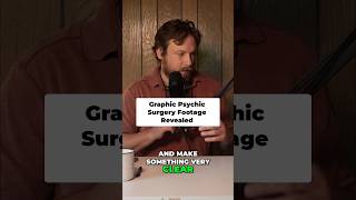 Arigo’ the psychic surgeon. Shocking footage. FULL VIDEO live now #psychic #surgery #paranormal