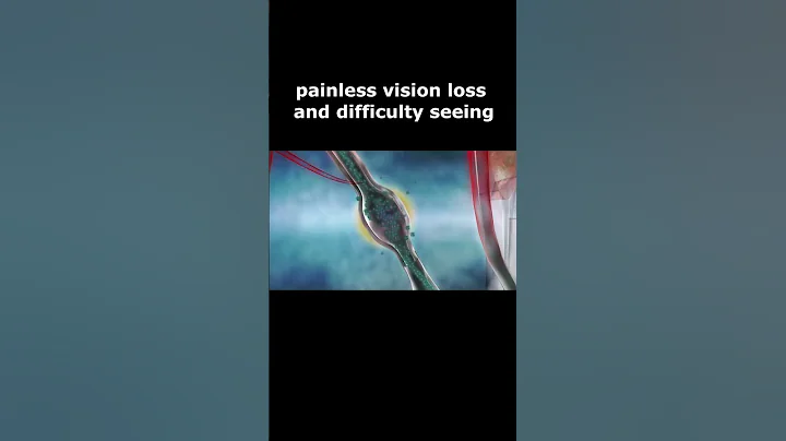 Retinal artery occlusions - DayDayNews