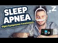 Sleep Apnea - Signs, Symptoms & Treatments
