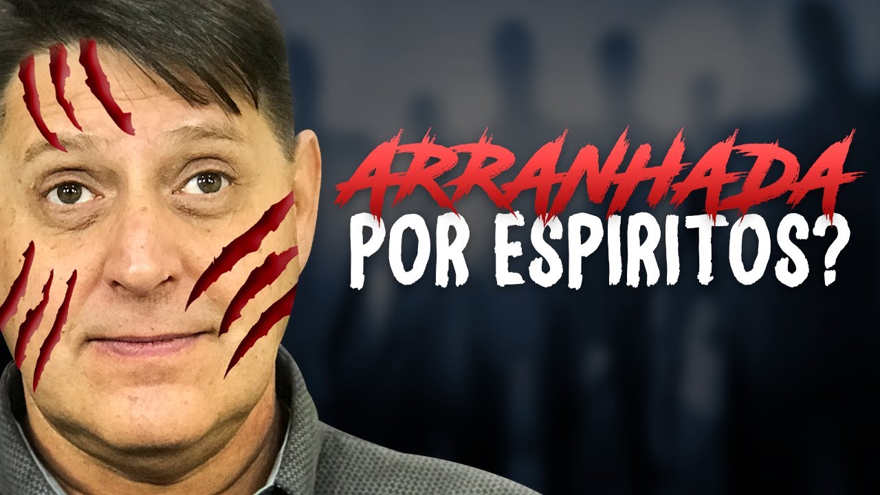 Aparecer Arranhões No Corpo Do Nada Espiritismo - RETOEDU