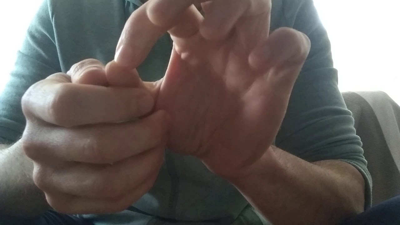 NOVA HAİR VE FOLLİGRAFT GERÇEĞİ PART 1