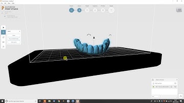 MICROLAY VERSUS | Preparing a bridge (Automatic support generation)