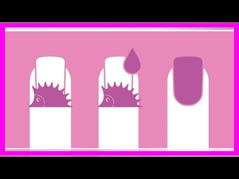 Почему появляются заусенцы и как от них избавиться