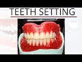 Complete Teeth Setting | Prosthodontics