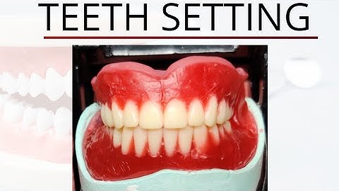 Complete Teeth Setting | Prosthodontics
