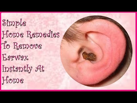 How To Get Rid Of Hard Ear Wax 86