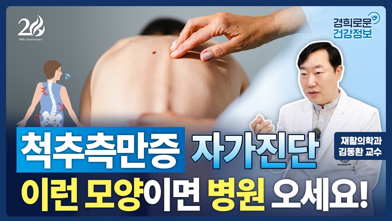 아이 척추측만증 집에서 확인하는 방법 [재활의학과 김동환 교수]