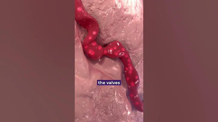 How do we diagnose venous insufficiency?