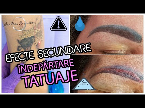 Video: Care sunt efectele secundare ale Vetmedin la câini?