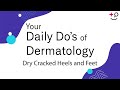Dry Cracked Heels and Feet - Daily Do's of Dermatology