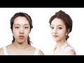 Top 5 Drastic Korean Plastic Surgery TV Show Transformations | Seoul Guide Medical