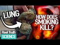 BIGGEST Consumer KILLER?: The Seduction of SMOKING | Ep 1 | Science Documentary | Reel Truth Science