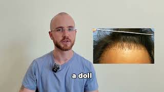 3D Patient's Experience  - 3D Transplanner by TrichoLAB