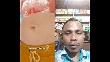 why do some people have an outie belly button 🥴#short -creativelearning3d