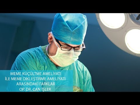 Meme Küçültme Ameliyatı Ile Meme Dikleştirme Ameliyatının Farkları - Op. Dr. Can İşler